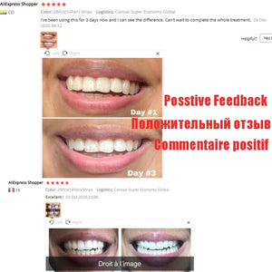 5D Gel Teeth Whitening Strips White Tooth