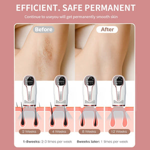 IPL Laser Hair Removal Device Full Body